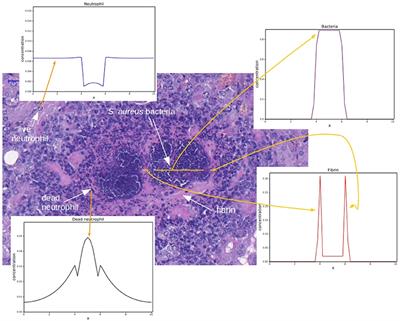 Development of a Computational Model of Abscess Formation